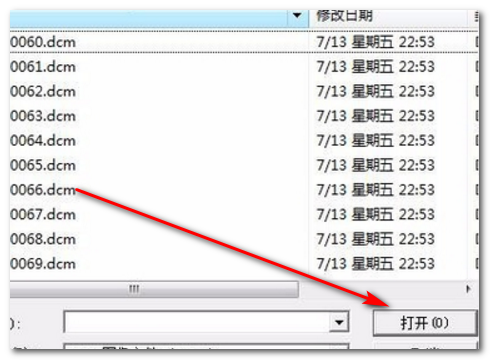 dcm文件怎么打开?dcm文件用什么软件可以打开?