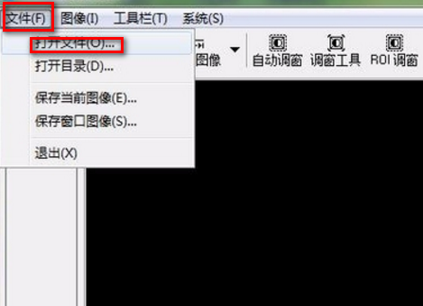 dcm文件怎么打开?dcm文件用什么软件可以打开?