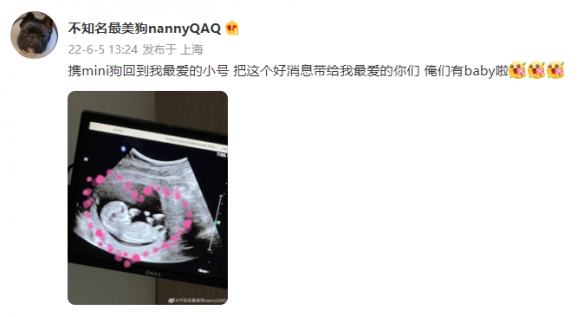 恭喜Uzi升级当奶爸！女友宣布怀孕喜讯：闷声放大招！