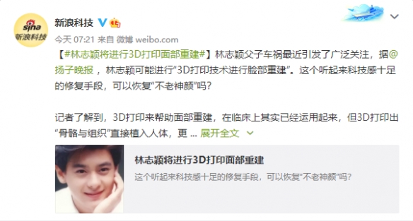 “不老神颜”恢复有望？林志颖将进行3D打印面部重建
